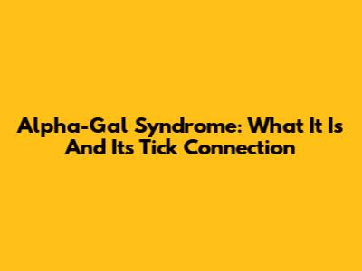 Alpha-Gal Syndrome: What It Is And Its Tick Connection