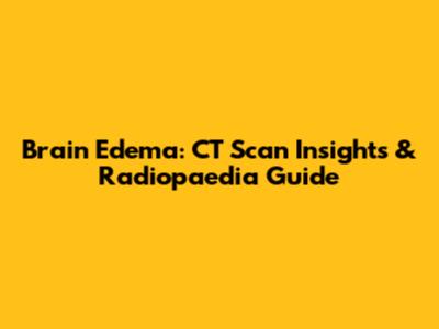 Brain Edema: CT Scan Insights & Radiopaedia Guide