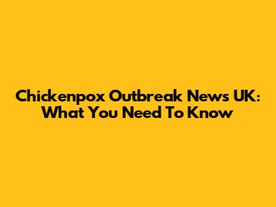 Chickenpox Outbreak News UK: What You Need To Know