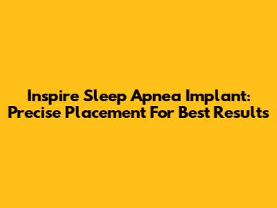 Inspire Sleep Apnea Implant: Precise Placement For Best Results