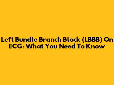 Left Bundle Branch Block (LBBB) On ECG: What You Need To Know