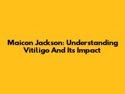Maicon Jackson: Understanding Vitiligo And Its Impact