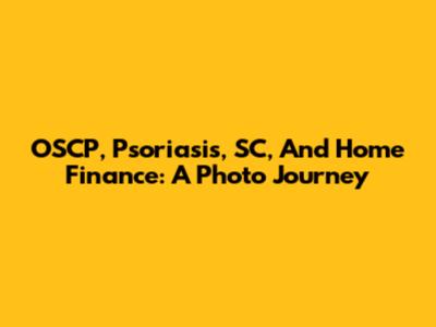 OSCP, Psoriasis, SC, And Home Finance: A Photo Journey