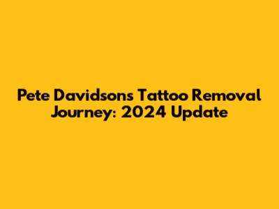 Pete Davidson's Tattoo Removal Journey: 2024 Update