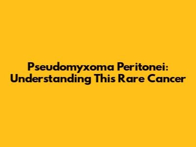 Pseudomyxoma Peritonei: Understanding This Rare Cancer