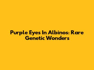 Purple Eyes In Albinos: Rare Genetic Wonders
